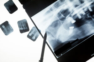 Equipamento de raios-x: entenda a importância para a sua empresa